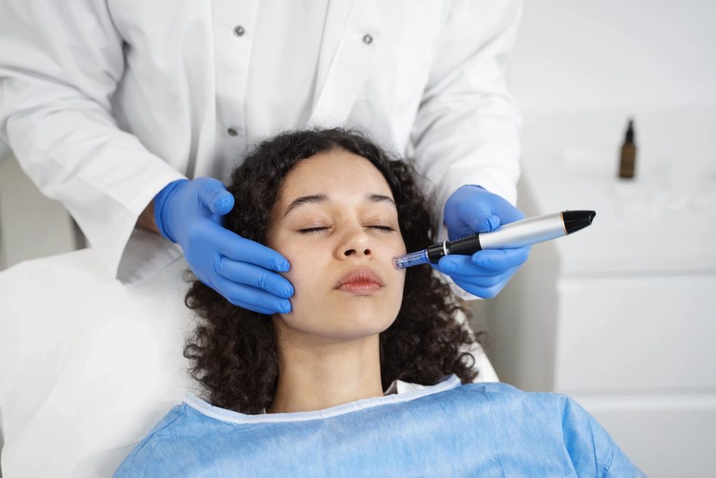 Scar Microneedling