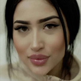 Rhinoplasty Before & After Patient #4149