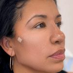 Fillers + Thread Lift Before & After Patient #4292