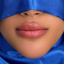 Russian Lips Before & After Patient #4331