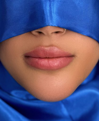 Russian Lips Before & After Patient #4331