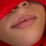 Russian Lips Before & After Patient #4337