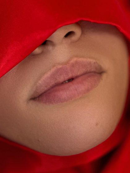 Russian Lips Before & After Patient #4337