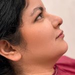 Chin Liposuction Before & After Patient #4237
