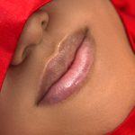 Russian Lips Before & After Patient #4391