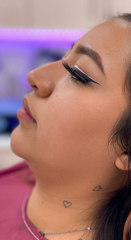 Chin Liposuction Before & After Patient #4249