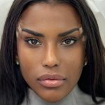 Fox Eye Threadlift Before & After Patient #4381