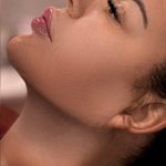 Chin Liposuction Before & After Patient #4262