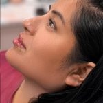 Chin Liposuction Before & After Patient #4234