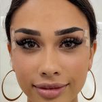 Fox Eye Threadlift Before & After Patient #4370