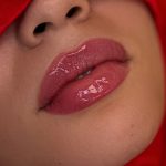 Russian Lips Before & After Patient #4337